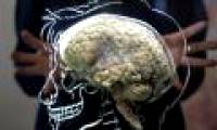 The scientist claims to help the brain dead again