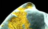 The shape of bacteria attaches to human teeth