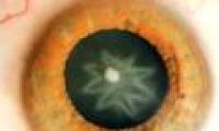 The star appears in the eye after being punched
