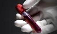 The things doctors won't reveal in your blood test