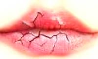 The treatment is common during the cold season, making the mouth always dry