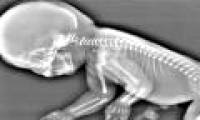 The unborn child grows like a mermaid in the womb
