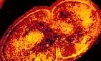 The United States modulates extremely powerful antibiotics against bacteria