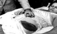 The woman who was hit by a meteorite