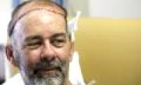 The world's first skull transplant