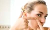 There will be vaccines for acne