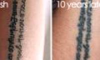 These images will make you think again before you want to go tattooing