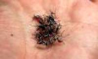 These mosquitoes look so real that anyone who wants to see them wants to beat them