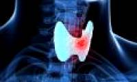 These types of cancer have a hereditary lifetime that you should know