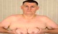 Things you don't know about big breast disease in men