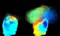 Thinking device in human brain