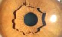 This is the eyes of a person, but why is this weird?