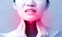 Throat cancer: Causes, symptoms and treatment