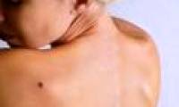 Tips to look at moles to know if cancer is present