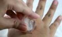Toothache is crazy but only 5 minutes to do this, the pain will disappear