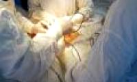 Treating breast cancer with new TomoDirect device