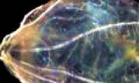 Treatment of neurological disorders by jellyfish brain