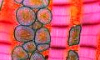 Turn skin cells into heart muscle cells