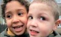 Twins are different in skin color