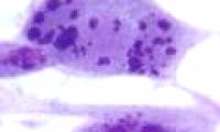 Two-thirds of the world's population is infected with sexually transmitted viruses