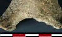 Unbelievable ways of healing from the Stone Age