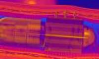 Unique injection technology does not hurt by stabbing needles straight into the intestinal wall