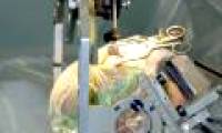 Use microelectrodes to bring drugs into the brain