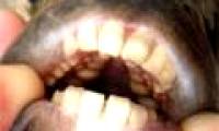 Video: Fish have human-like teeth