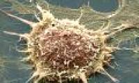 Vinegar helps detect cervical cancer