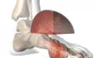 Vitamin C reduces the risk of gout