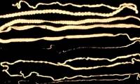 Whale Tapeworm - The World's Longest Parasite