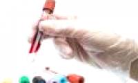 What blood tests can you know about?