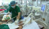 What is the A/H1pdm influenza strain?
