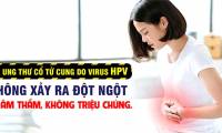 What you need to know about HPV vaccination