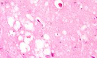 Which infectious diseases have a mortality rate close to 100%?