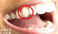Why do humans have sharp fangs?