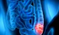 Why do many young people have cancer?