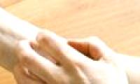 Why do you scratch the itch?