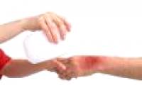 Why does it take too long to heal?