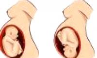 Why does the fetus not turn its head?