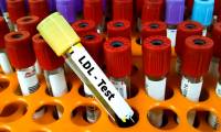 Why does veganism still increase cholesterol?