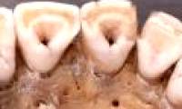 Why is it that only East Asians and Native Americans have milk teeth shovels?
