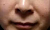 Why not count all ... moles?
