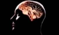 Wi-Fi waves are harmful to the brain