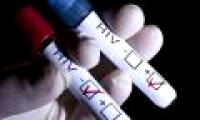 Will HIV be eliminated in 2030?