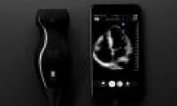 Will mobile ultrasound detect a revolution?