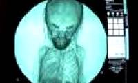 X-ray film reveals the secret of a thousand-year-old coffin